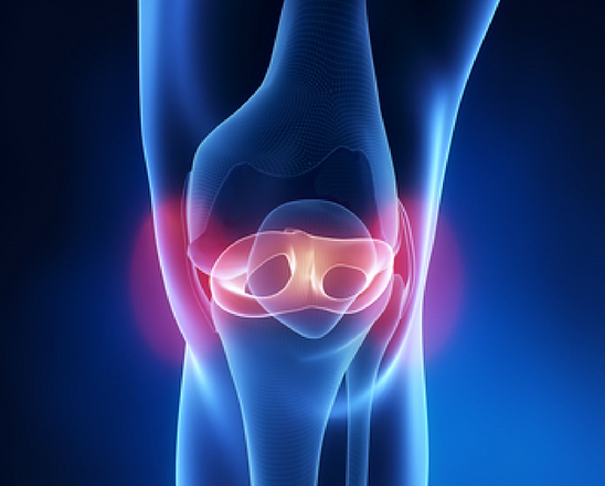 ACL treatment