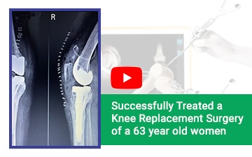 Knee Replacement Surgery of a 63-year-old woman
