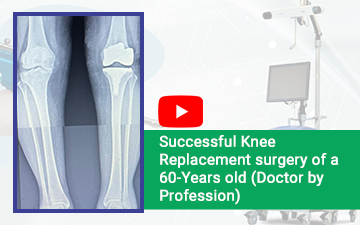 Patient's story of Success & Happiness - Knee Replacement surgery